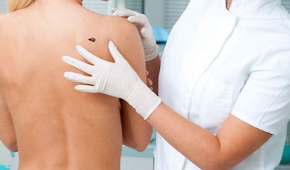 atencion dermatologica